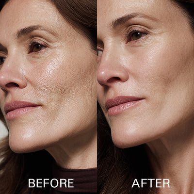 Purevia® Hyaluronic Acid Powder